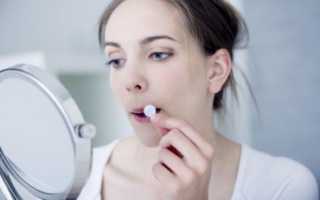 Инфекция цитомегаловирусная