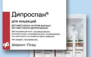 Как колоть Дипроспан при псориазе?