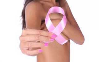 Аденома молочной железы