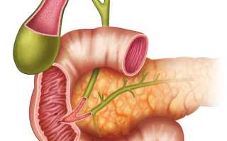 Гастродуоденит