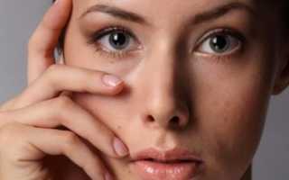 Причины появления отеков под глазами