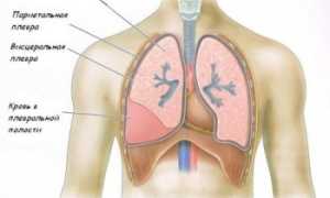 Все о гемотораксе