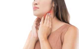 Лимфаденит