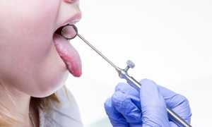 Назначают ли Беродуал при ларингите?