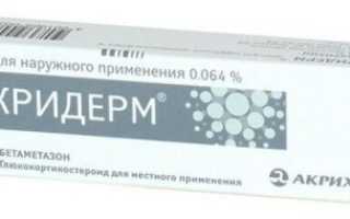 Помогает ли Акридерм от псориаза?