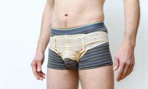 Все о паховой грыже