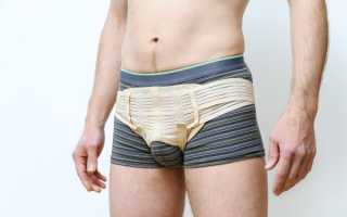 Все о паховой грыже