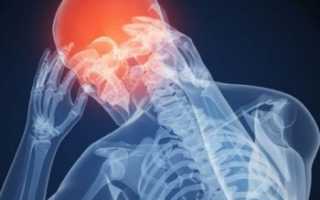 Все о агнозии