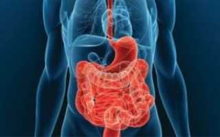 Все о болезни Крона