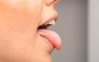 Аденома слюнной железы