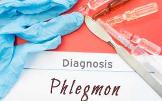 Флегмона