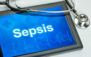 Сепсис