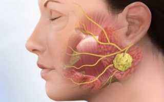 Плеоморфная аденома