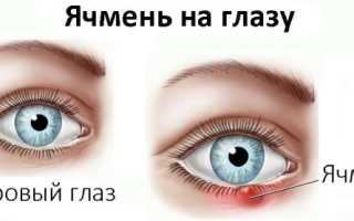 Можно ли ячмень мазать Ацикловиром?