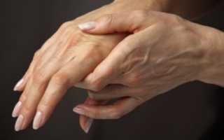 Почему немеют пальцы на правой руке?