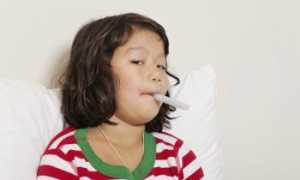 Синдром Кавасаки