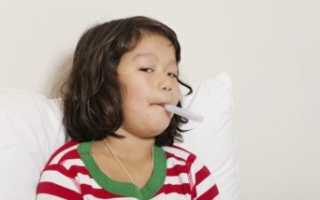 Синдром Кавасаки