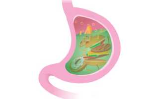 Дискинезия желчевыводящих путей