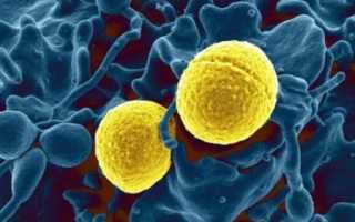 Золотистый стафилококк в кишечнике