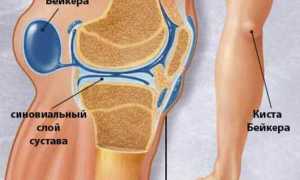 Почему болит колено с внутренней стороны?