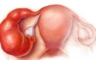 Все о вульвовагините