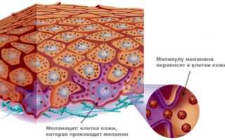 Как убрать пигментные пятна с помощью Перекиси водорода?