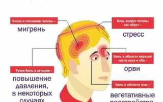 Головная боль в висках