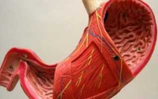 Язва желудка