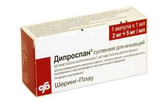Дипроспан — инструкция и цена