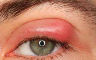 Можно ли применять Левомеколь при ячмене на глазу?
