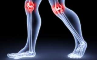 Как принимать Аспирин от боли в суставах?