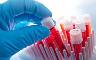 Лейкоцитоз