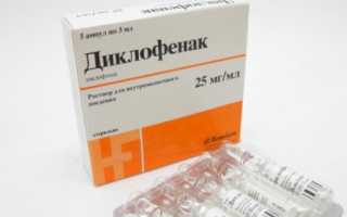 Лечение остеохондроза Диклофенаком