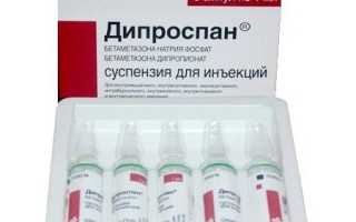Применение Дипроспана при грыже позвоночника