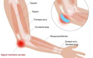 Почему болит локоть – симптомы заболеваний локтевого сустава