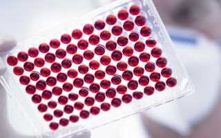 Тромбоцитопения