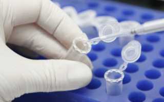 Антиген плоскоклеточной карциномы