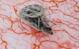 Все о лямблиозе