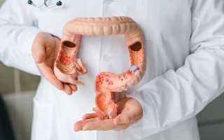 Прямая кишка