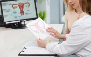 Все о карциноме матки