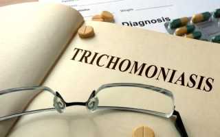 Трихомониаз