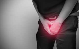 Воспаление крайней плоти у мужчин