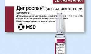 Как применять Дипроспан при артрите?