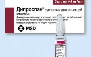 Как применять Дипроспан при артрите?