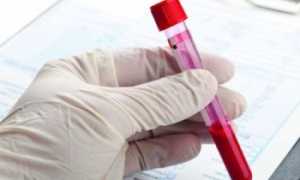 Болезнь Виллебранда