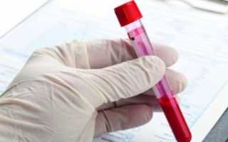 Болезнь Виллебранда