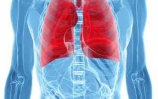 Легочная гипертензия