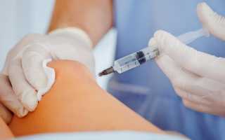 Для чего делают уколы с гиалуроновой кислоты в колено?