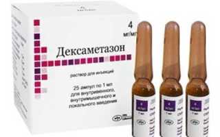 Как колоть Дексаметазон при аллергии?