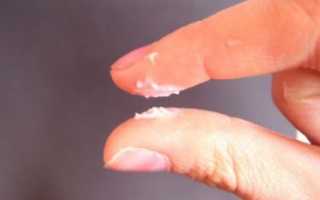 Могут ли быть выделения после Бетадина?